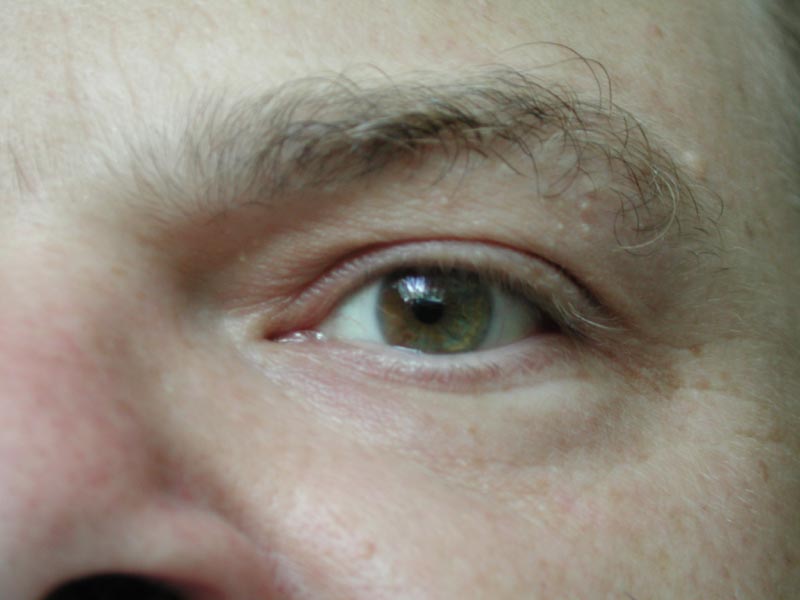 Bryan's eye.jpg 43.1K